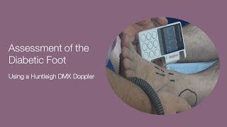 Assessment of the Diabetic Foot using a DMX Doppler [upl. by Marve]