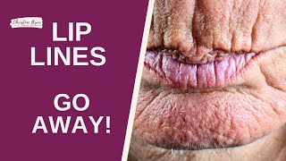 FIX LIP LINES 8 WAYS TO IMPROVE THEM [upl. by Diehl163]