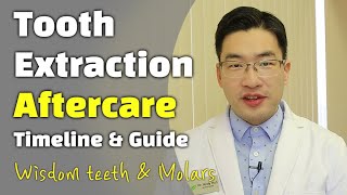 Aftercare Instruction Tooth Extraction Wisdom teeth removal molars front teeth Evergreen Dental [upl. by Chaing]