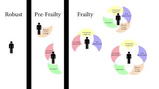 Measuring Frieds Frailty Phenotype [upl. by Primaveria787]