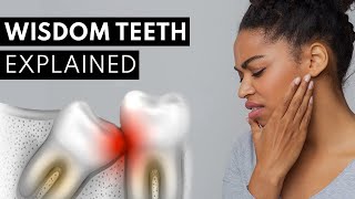 Wisdom Teeth Explained Pain Symptoms amp Extractions [upl. by Yenar]