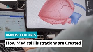 AMBOSS Features How Medical Illustrations are Created [upl. by Eiramlatsyrc290]