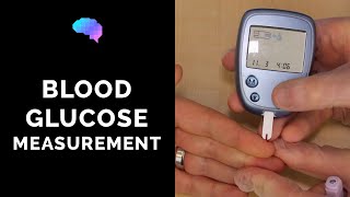 Blood Glucose Measurement  CBG  OSCE Guide  UKMLA  CPSA  PLAB 2 [upl. by Recnal]