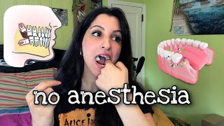 Wisdom Teeth Survival Guide NO General Anesthesia [upl. by Nylzor]