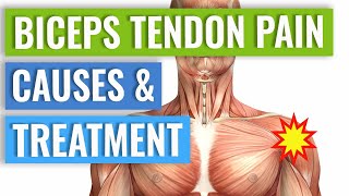 Biceps Tendonitis Treatment and Exercises Explained [upl. by Alric]