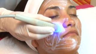 Radiofrecuencia Facial o Lifting sin cirugía [upl. by Shanley285]