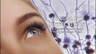 Fungal Eye Infections and Some Common Fungi That Can Cause Them [upl. by Enilarac923]