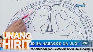 Unang Hirit Ano ang dapat gawin kapag nauntog o nabagok ang ulo [upl. by Tabbatha]