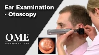 Otoscopy Ear Examination  ENT [upl. by Farant]