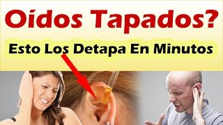 OIDOS TAPADOS Como Destapar Un Oido En Minutos Con Estos Increíblemente Efectivos Remedios [upl. by Dori541]