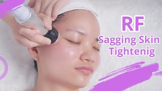 RF FACIAL NON SURGICAL FACELIFT  HOW TO USE RADIO FREQUENCY  FACE SKIN TIGHTENING TREATMENT 1391 [upl. by Caniff]