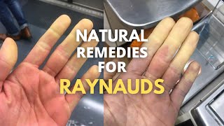 3 Questions Answered about Raynauds Syndrome [upl. by Demmer]