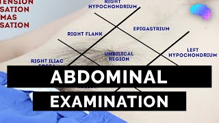 Abdominal Examination  OSCE Guide Latest  UKMLA  CPSA  PLAB 2 [upl. by Ehcar189]