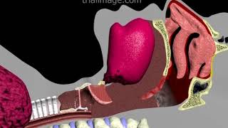 Endotracheal Intubation Animation by Cal Shipley MD [upl. by Dwyer495]