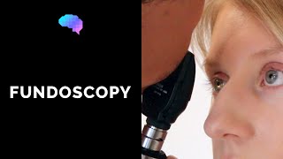 Fundoscopy Ophthalmoscopy  OSCE Guide  UKMLA  CPSA  PLAB 2 [upl. by Ehudd211]