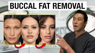 Plastic Surgeon EXPLAINS Buccal Fat Removal [upl. by Veejar]