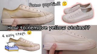 How to remove yellow stains on white shoes 4 Easy Steps [upl. by Raimund]