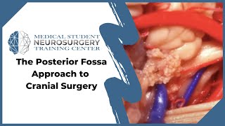 The Posterior Fossa Approach to Cranial Surgery [upl. by Celinka]