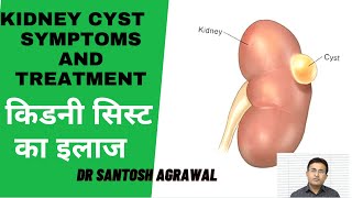 Kidney Cyst Treatment I Renal Cyst I Kidney Ki Gathan [upl. by Llebana]