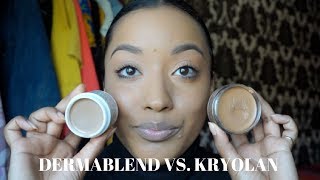 VITILIGO COVERAGE  DERMABLEND VS KRYOLAN MAKEUP [upl. by Heise]