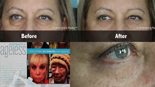 Instantly Ageless COMPLETE Review  Demo [upl. by Rosemari688]