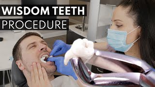 Wisdom Teeth Extraction PROCEDURE  How to Prepare What to Expect amp Cost [upl. by Ahsenyl496]