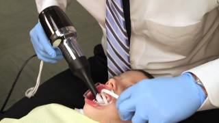 Rapid Palatal Expander Procedure Explained [upl. by Netloc]