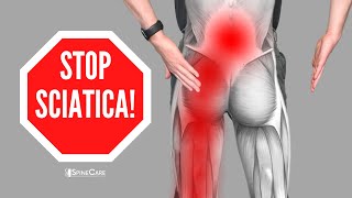 How to Relieve Sciatica Pain in SECONDS [upl. by Aztilay]