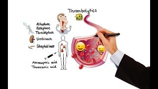 Superficial Vein Thrombophlebitis  The Essentials [upl. by Shandra]