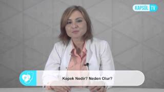 Kepek Nedir Neden Olur [upl. by Sane573]