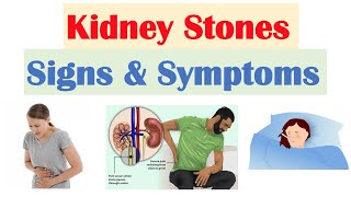 Kidney Stones Nephrolithiasis Signs amp Symptoms  amp Why They Occur [upl. by Brantley216]