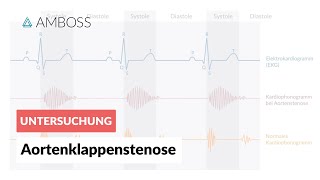 Aortenklappenstenose  Herzgeräusch  AMBOSS Video [upl. by Leanora]