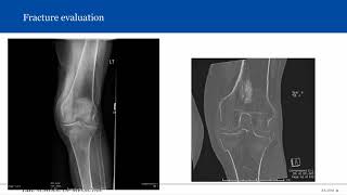 Introduction to Musculoskeletal Radiology [upl. by Ahseken]