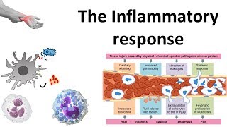 The Inflammatory response [upl. by Ssenav]