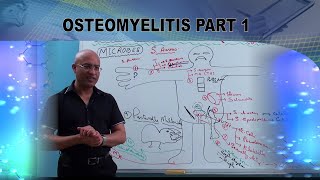 Osteomyelitis  Causes amp Symptoms  Bone Infection🩺 [upl. by Hen19]