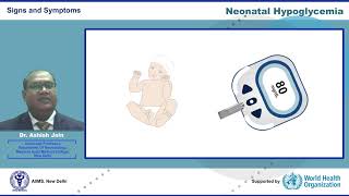 Neonatal Hypoglycemia [upl. by Britney]