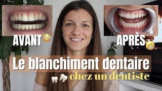 BLANCHIMENT DENTAIRE chez le dentiste prix durée sensibilité [upl. by Aliuqehs]