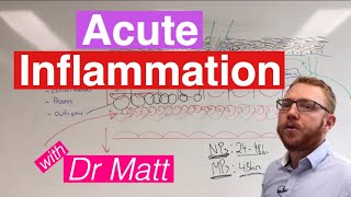 Acute Inflammation  Immunology [upl. by Sherburne63]