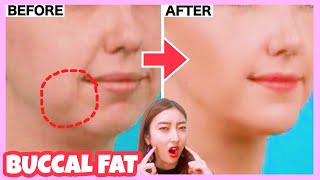 Buccal Fat Removal Exercise  Reduce Cheek Fat Chubby Cheeks No Surgery💕 [upl. by Kcirdnek860]