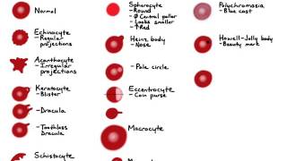 RBC Morphology [upl. by Noreik]