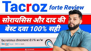 Tacroz Forte Ointment Review  Tacrolimus Ointment Uses Mode Of Action amp Side Effects In Hindi [upl. by Wilburt913]