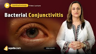 Bacterial Conjunctivitis  Ophthalmology Video Lecture  Medical Student VLearning [upl. by Cobby77]