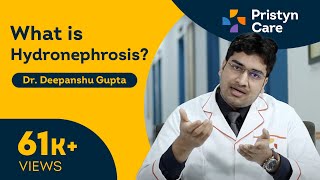 What is Hydronephrosis  Swelling of Kidney  For FREE Consultation Call On 6366526489 [upl. by Goddart]