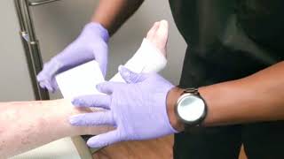 Unna Boot Application by Podiatrist Dr Ejiro Isiorho [upl. by Dayle]