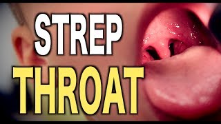 Strep Throat LIVE DIAGNOSIS [upl. by Eiuol]