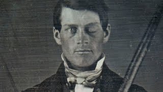 Why Scientists Are Still Fascinated By Phineas Gage [upl. by Ellenig]