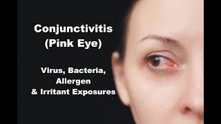 Conjunctivitis Pink Eye  Virus Bacteria Allergen amp Irritant Exposures [upl. by Keele486]