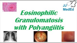 Eosinophils high in blood test means [upl. by Ithnan]