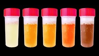 7 Choses Que Ton Urine Peut Révéler Sur ta Santé [upl. by Maroj]