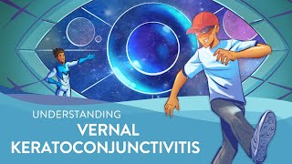 Understanding Vernal Keratoconjunctivitis VKC [upl. by Reema813]